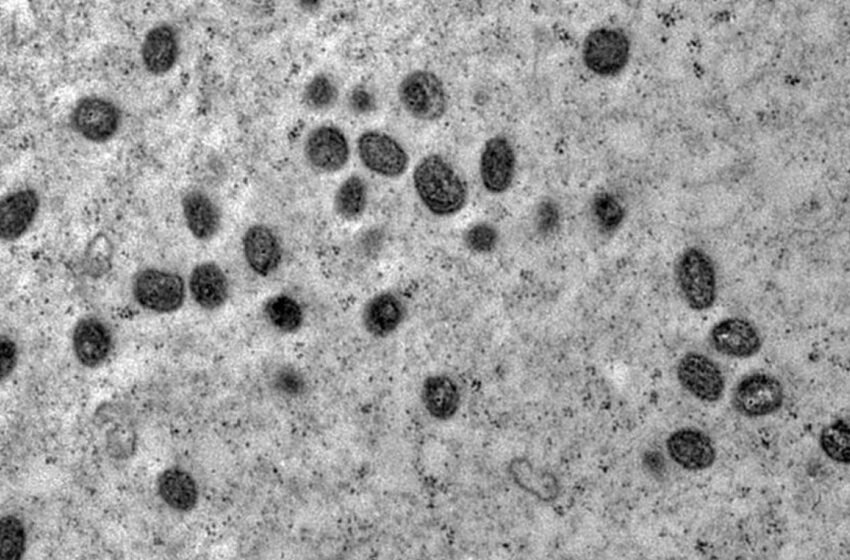  Brasil registra cerca de 1,5 mil casos de Mpox em 2024